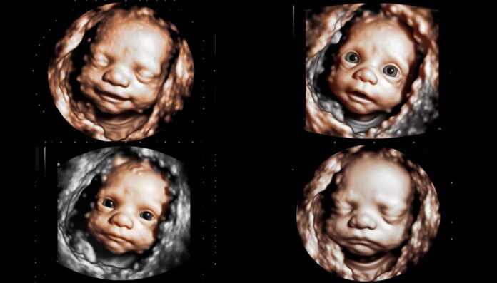 4D ultrasound collage showcasing a range of baby's first expressions in the womb: from joy and concern to wonder and curiosity.